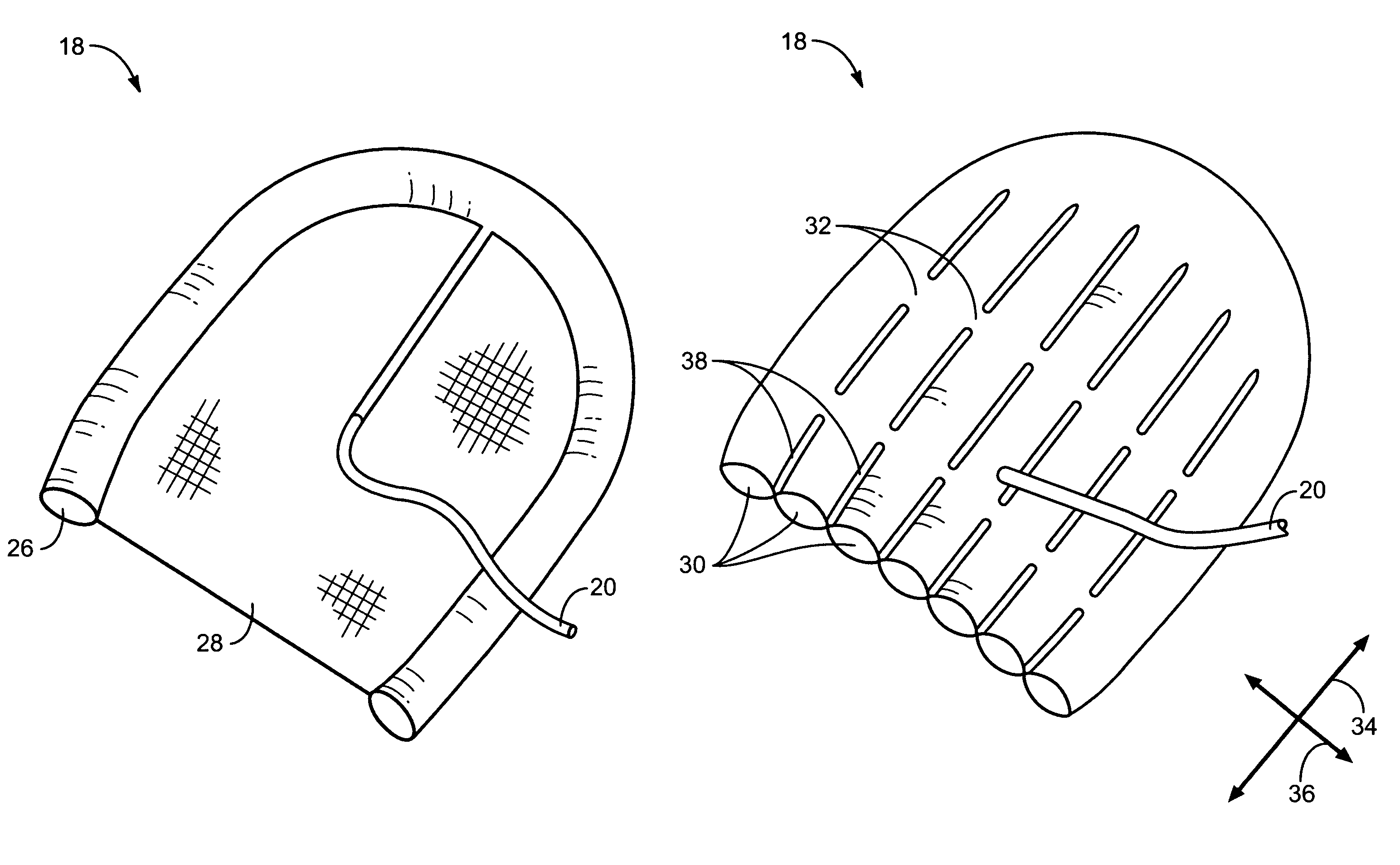 Inflatable hernia patch