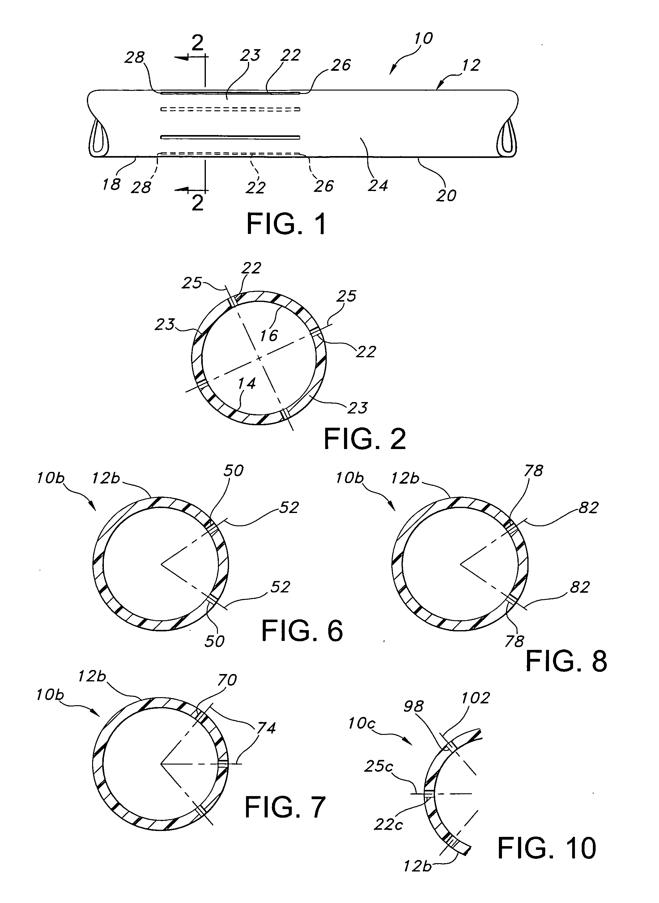 Sintered structures for vascular graft