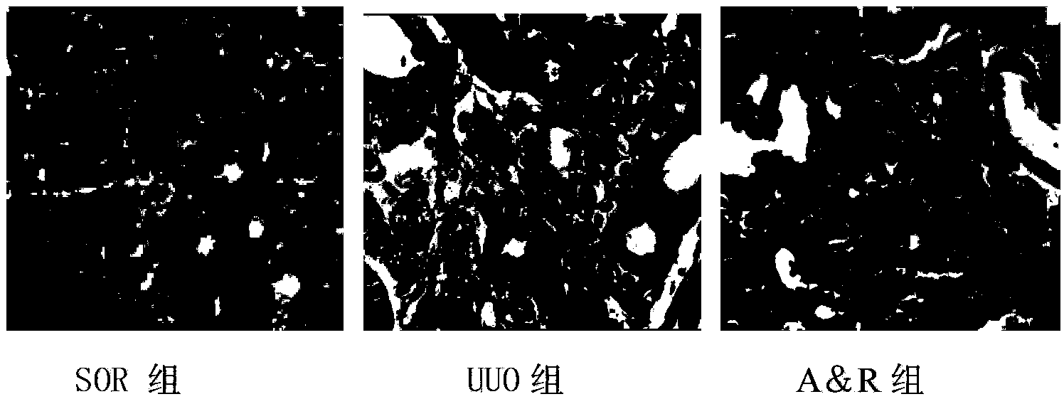 Medicine composite for treating chronic kidney diseases and preparation method and application of medicine composite