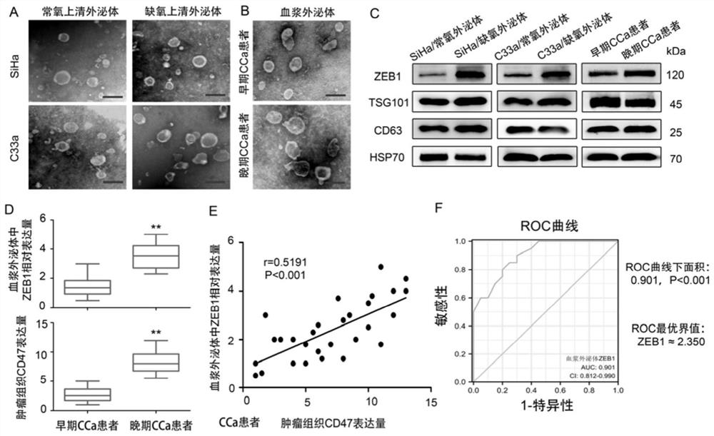 Marker for evaluating tumor tissue CD47 expression level in real time, and application of marker