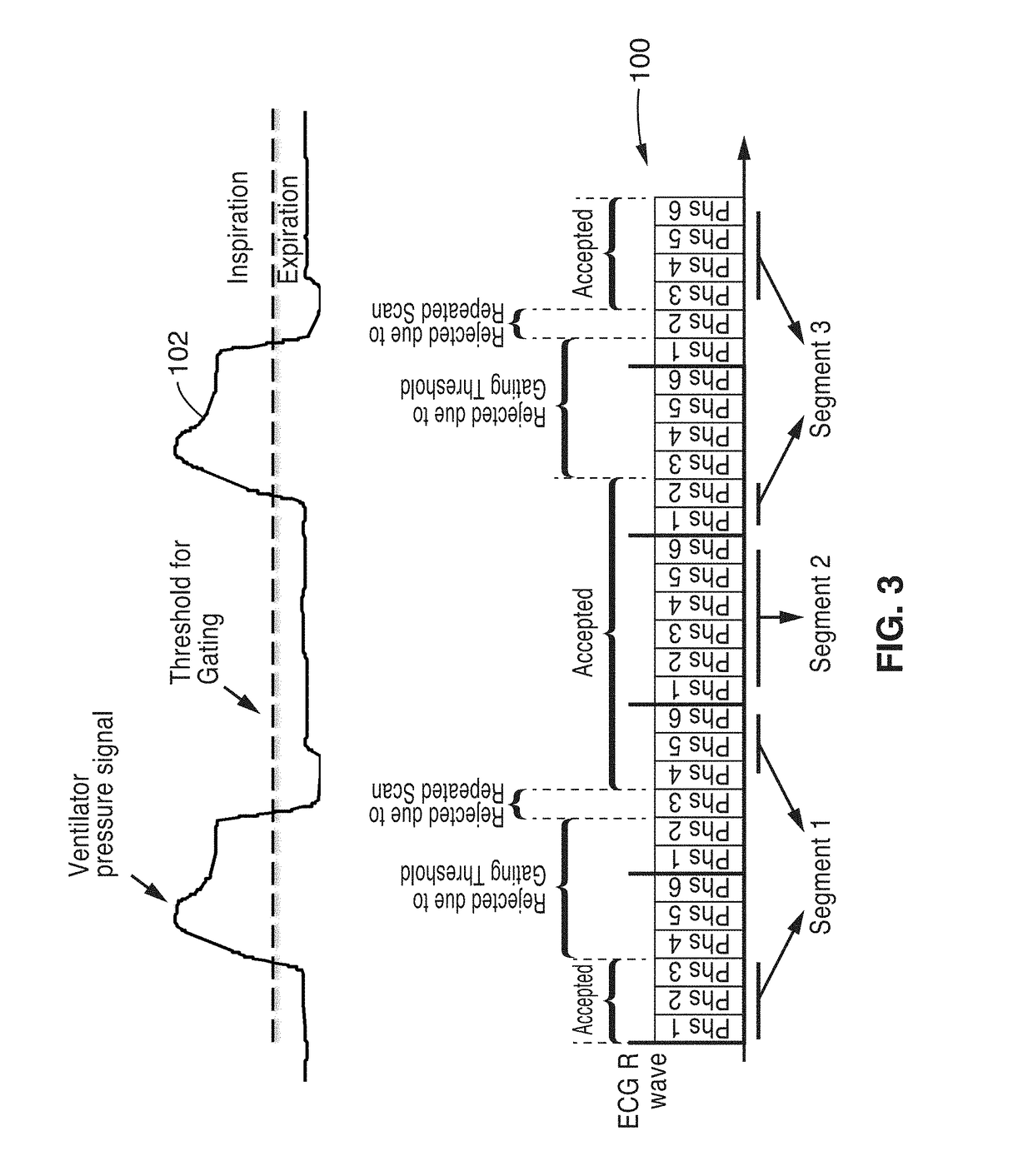 Cardiac phase-resolved non-breath-hold 3-dimensional magnetic resonance angiography