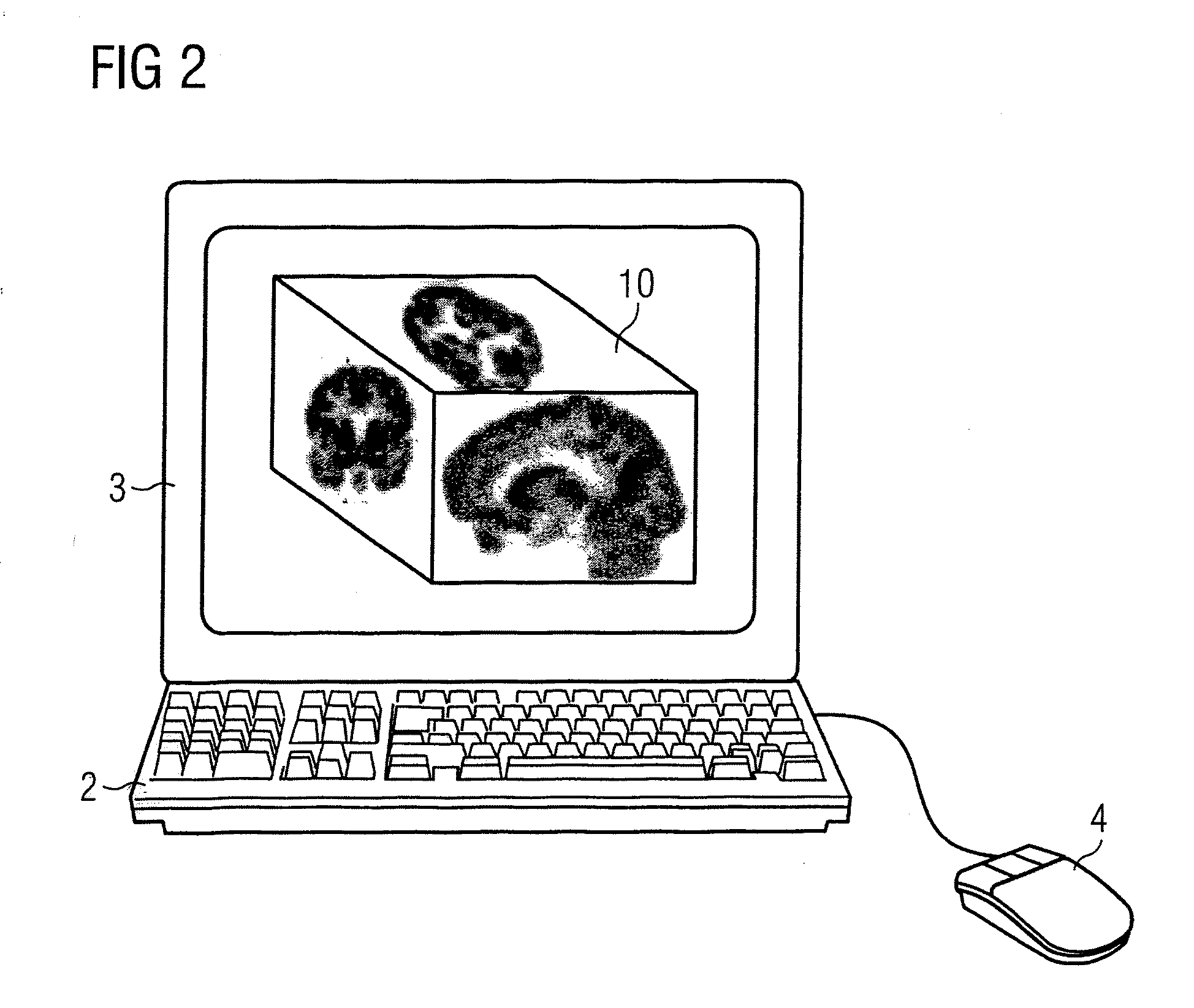 Method and user interface for the graphical presentation of medical data