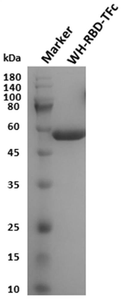 Neutralizing human monoclonal antibody aiming at novel coronavirus and application thereof