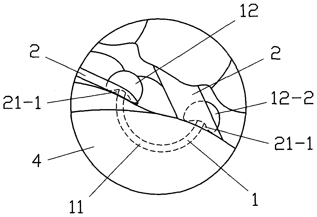 Tongue back elastic traction device and implantation method