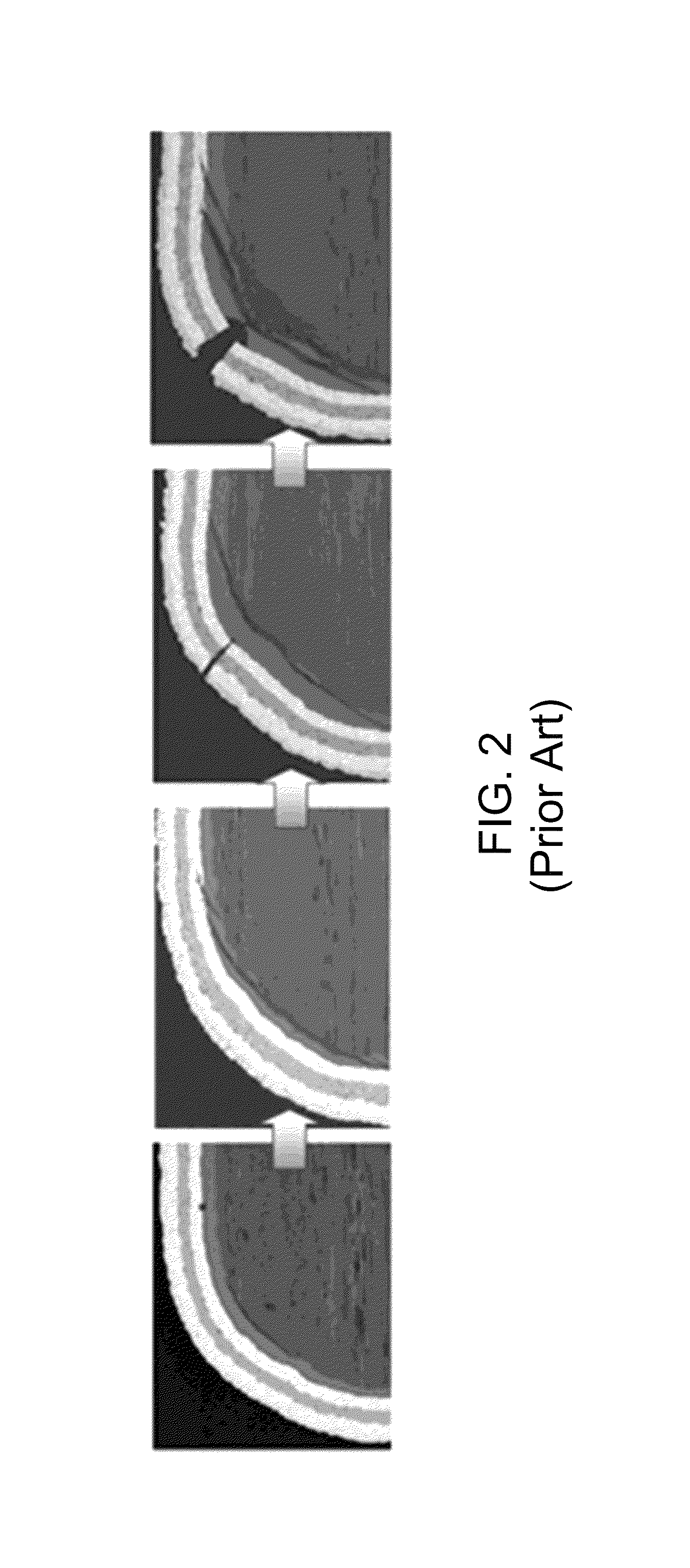 Crack-resistant environmental barrier coatings