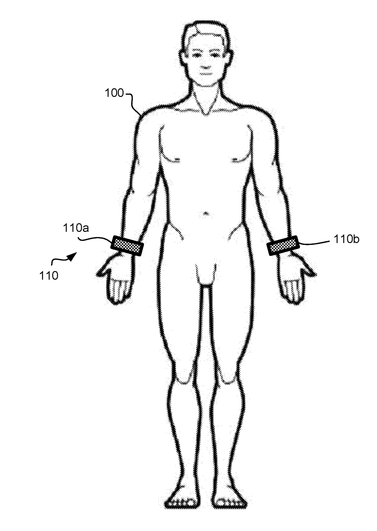 Systems and methods for electrostimulation therapy