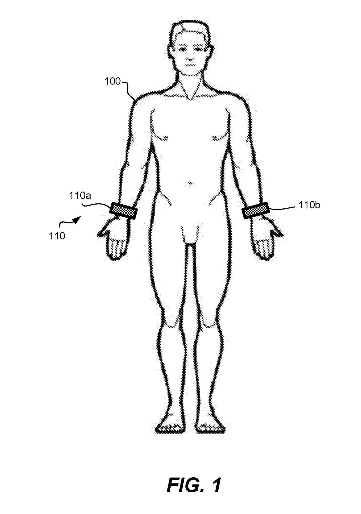 Systems and methods for electrostimulation therapy