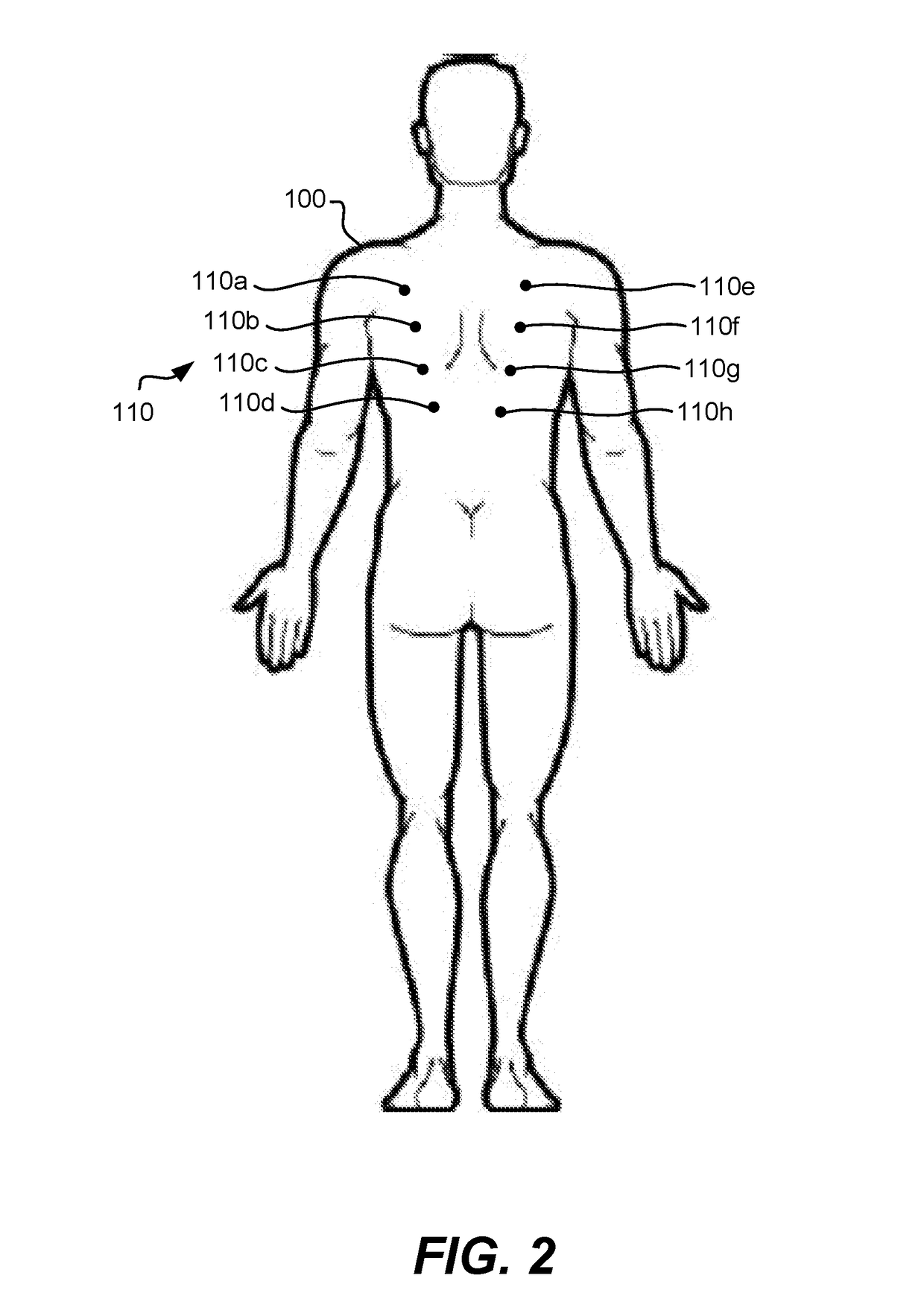 Systems and methods for electrostimulation therapy