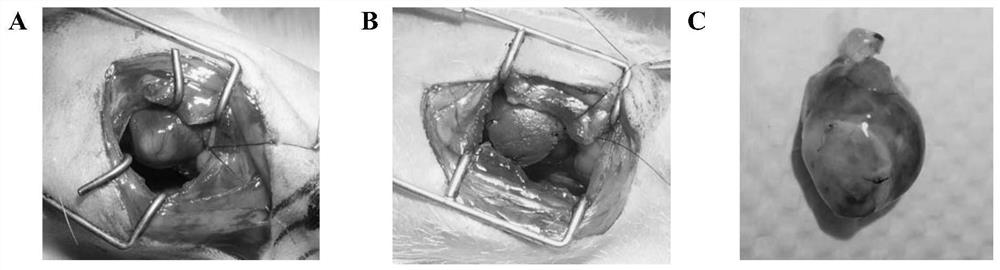 Active-oxygen-responsive degradable polyurethane heart patch for myocardial infarction repair and preparation method thereof