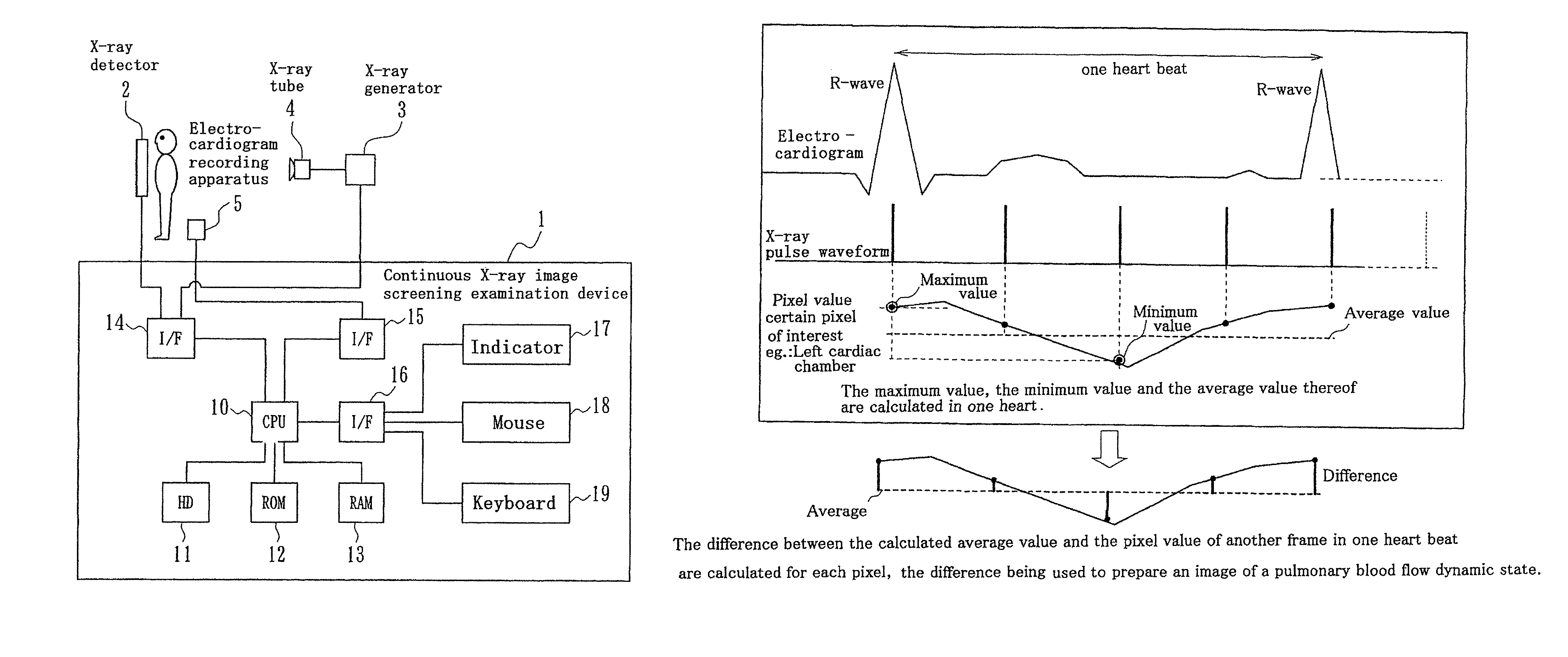 Continuous X-ray image screening examination device, program, and recording medium