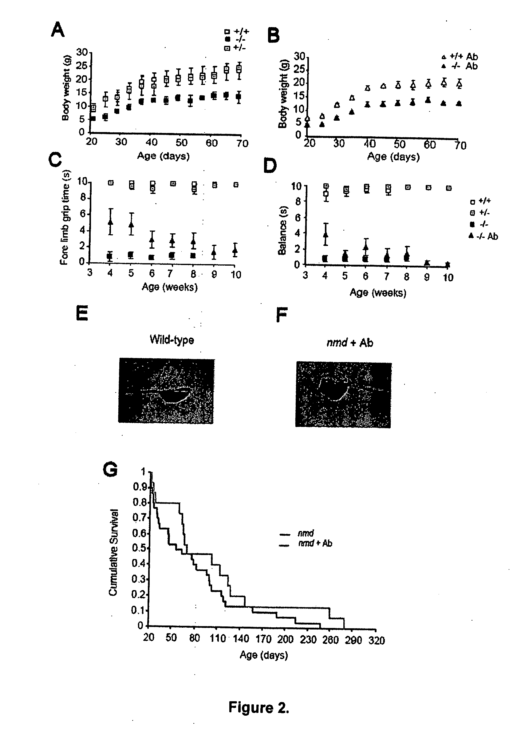 Methods for treating lower motor neuron diseases and compositions containing the same