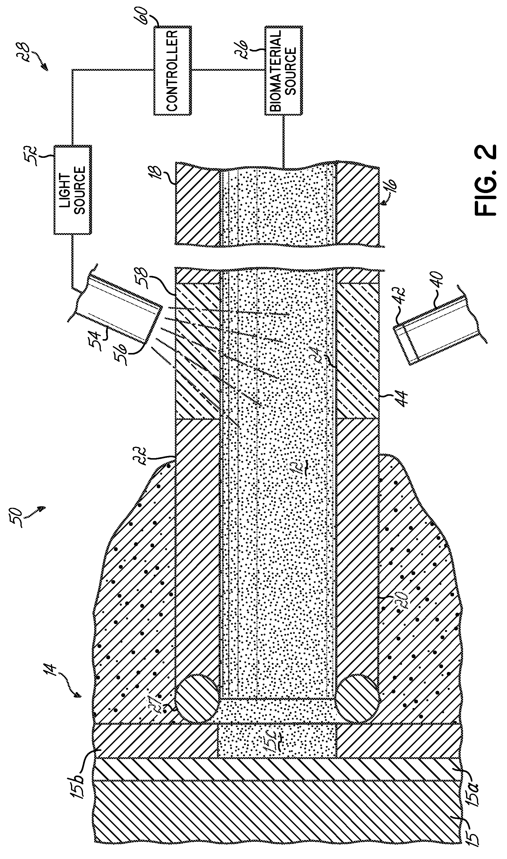 Apparatus and method for delivering a biocompatible material to a surgical site