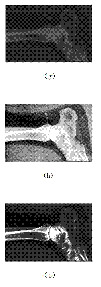 Image enhancement method implemented through histogram equalization