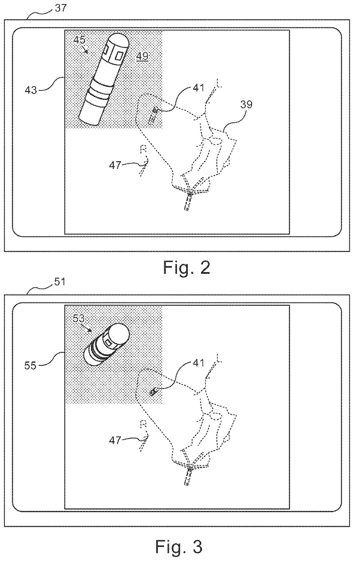 Graphical user interface for medical imaging system