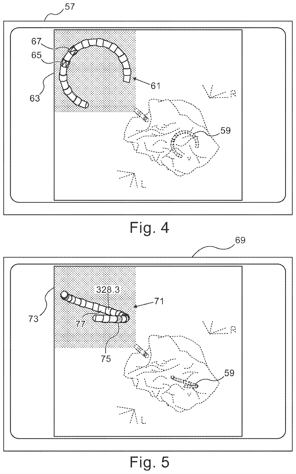 Graphical user interface for medical imaging system