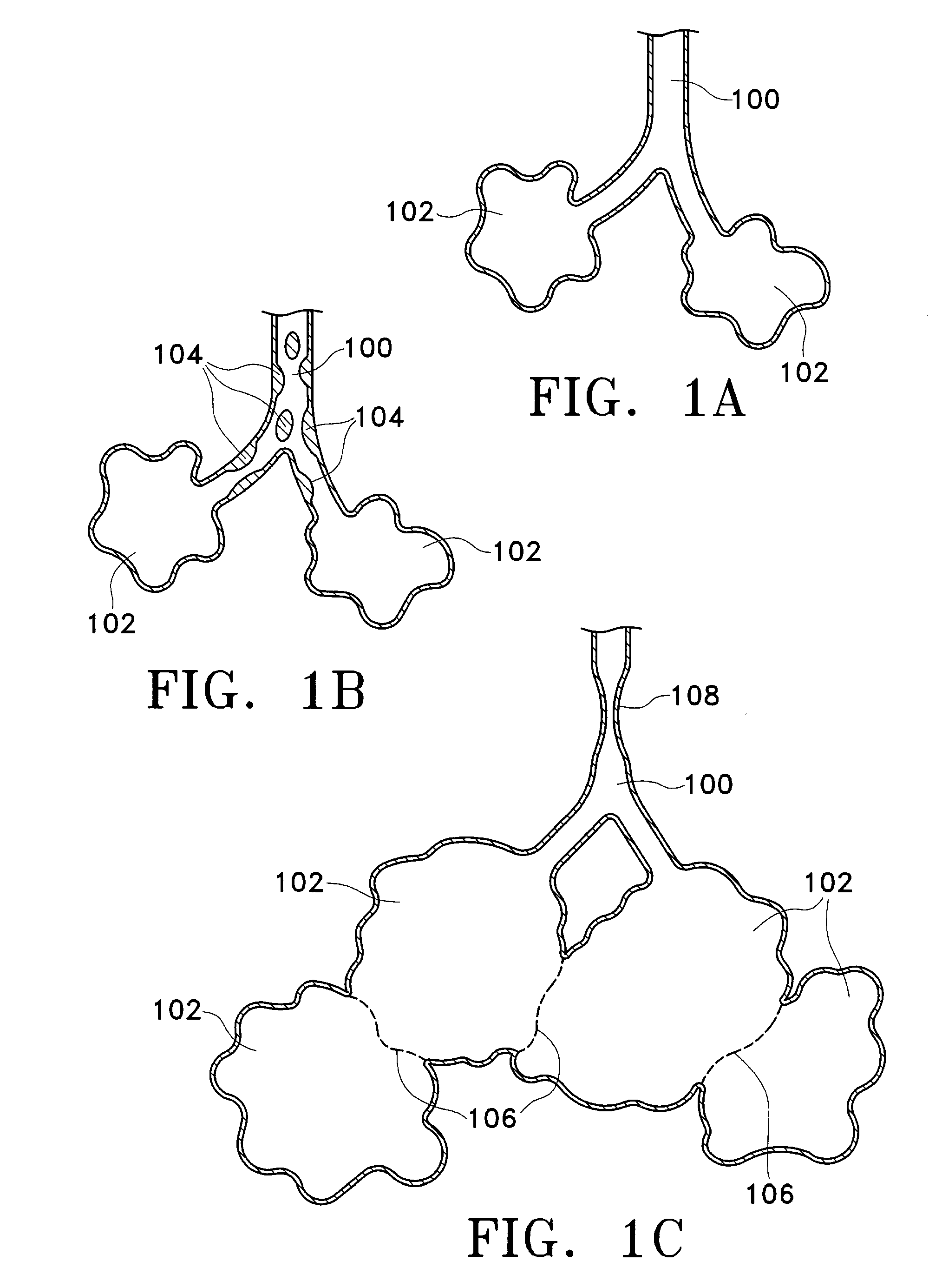 Methods for maintaining the patency of collateral channels in the lungs using cryo-energy