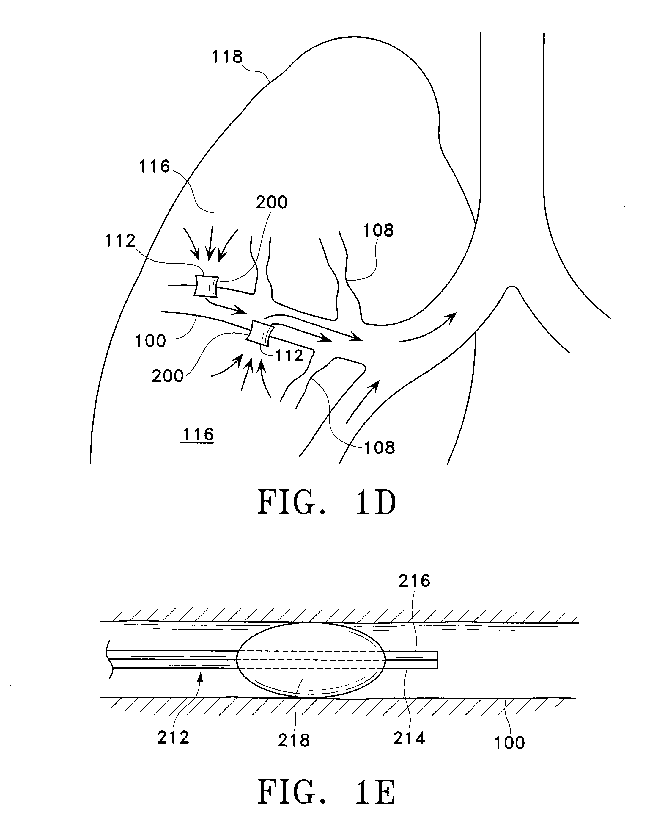 Methods for maintaining the patency of collateral channels in the lungs using cryo-energy