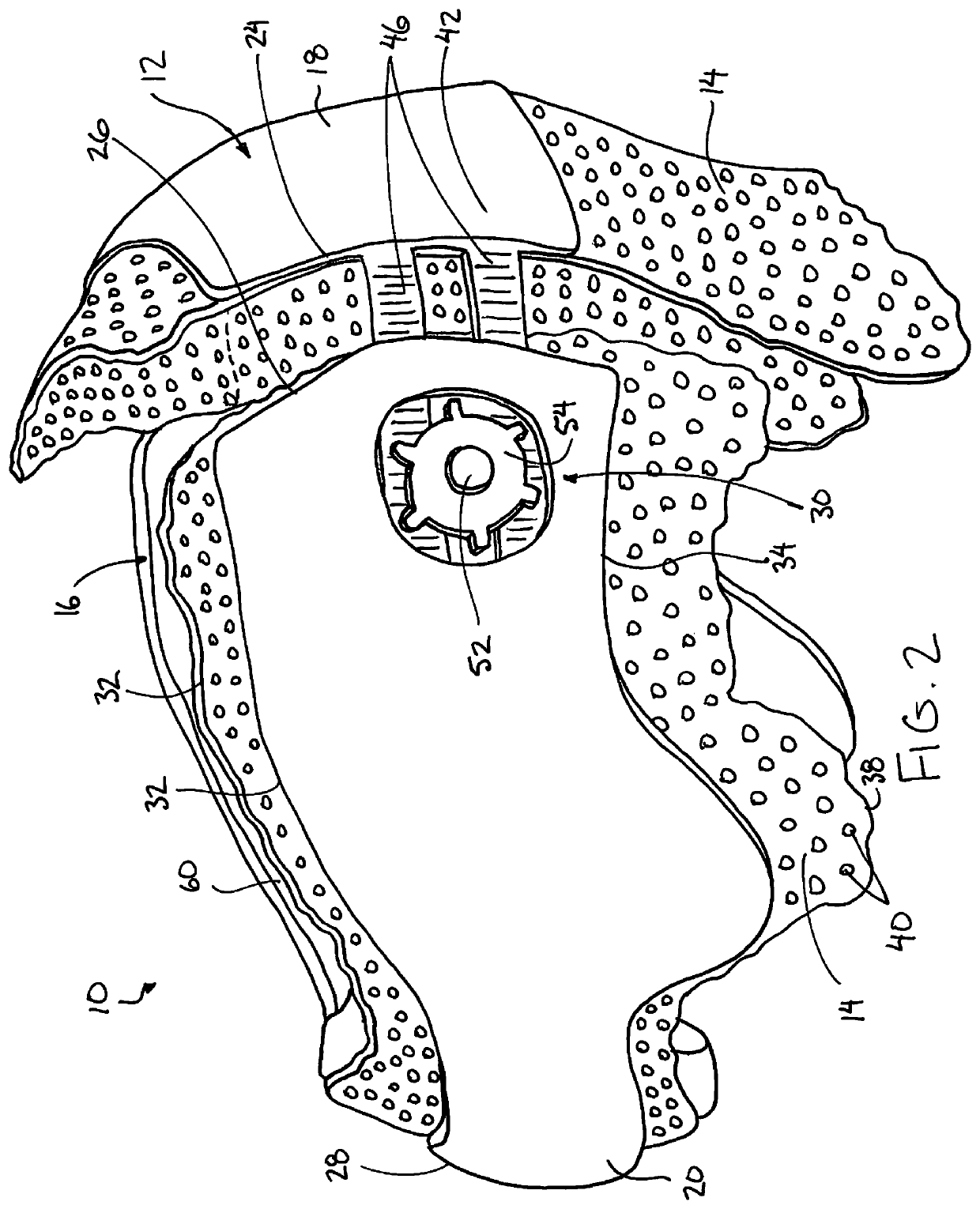 Prefabricated Customizable Cranial Remodelling Orthotic