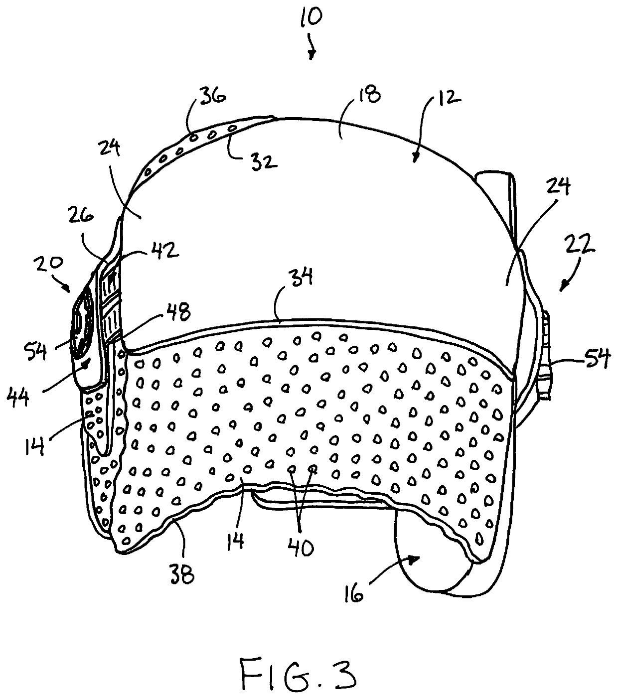 Prefabricated Customizable Cranial Remodelling Orthotic