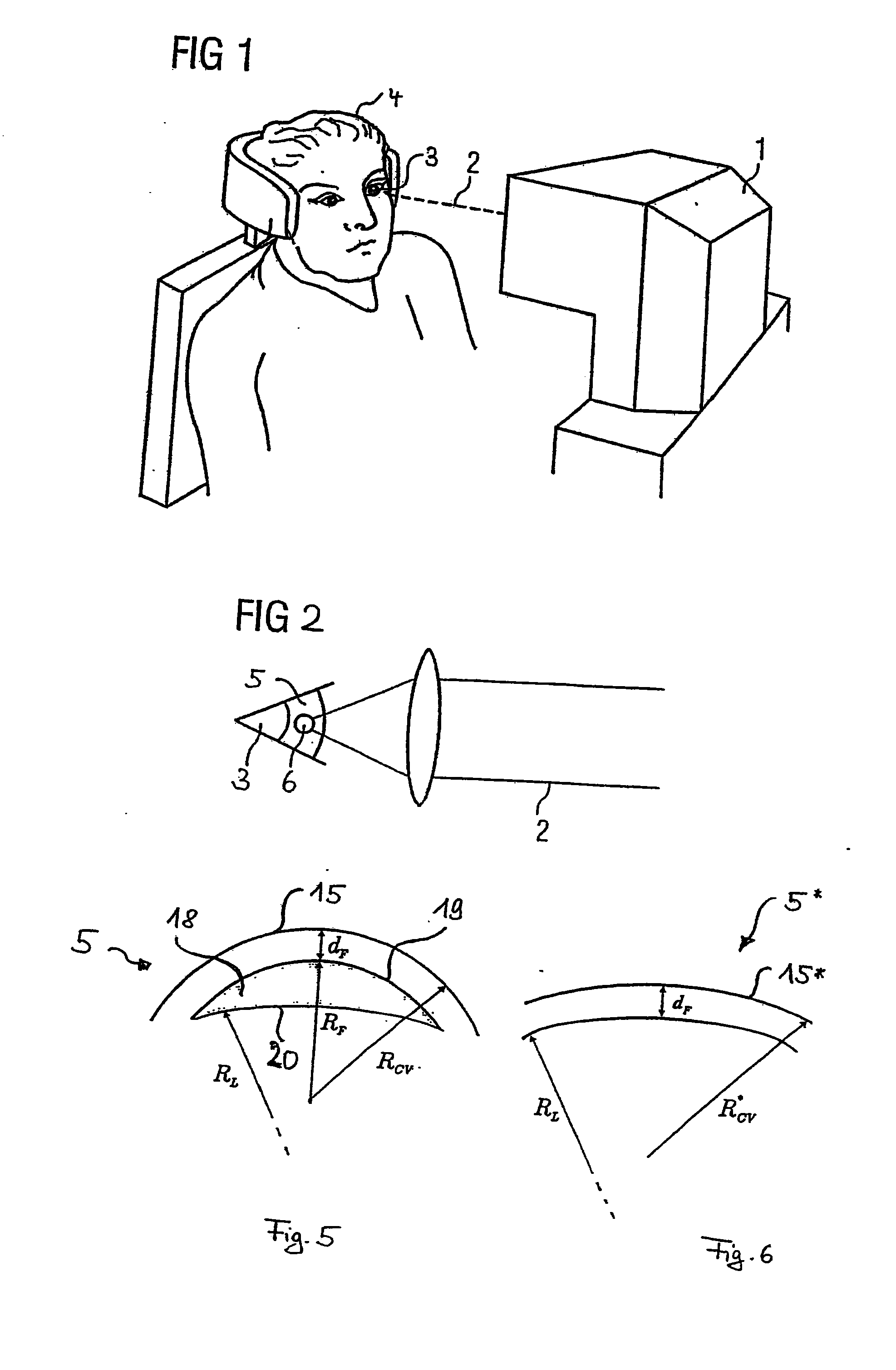 Treatment device for surgically correcting ametropia of an eye and method for creating control data therefore