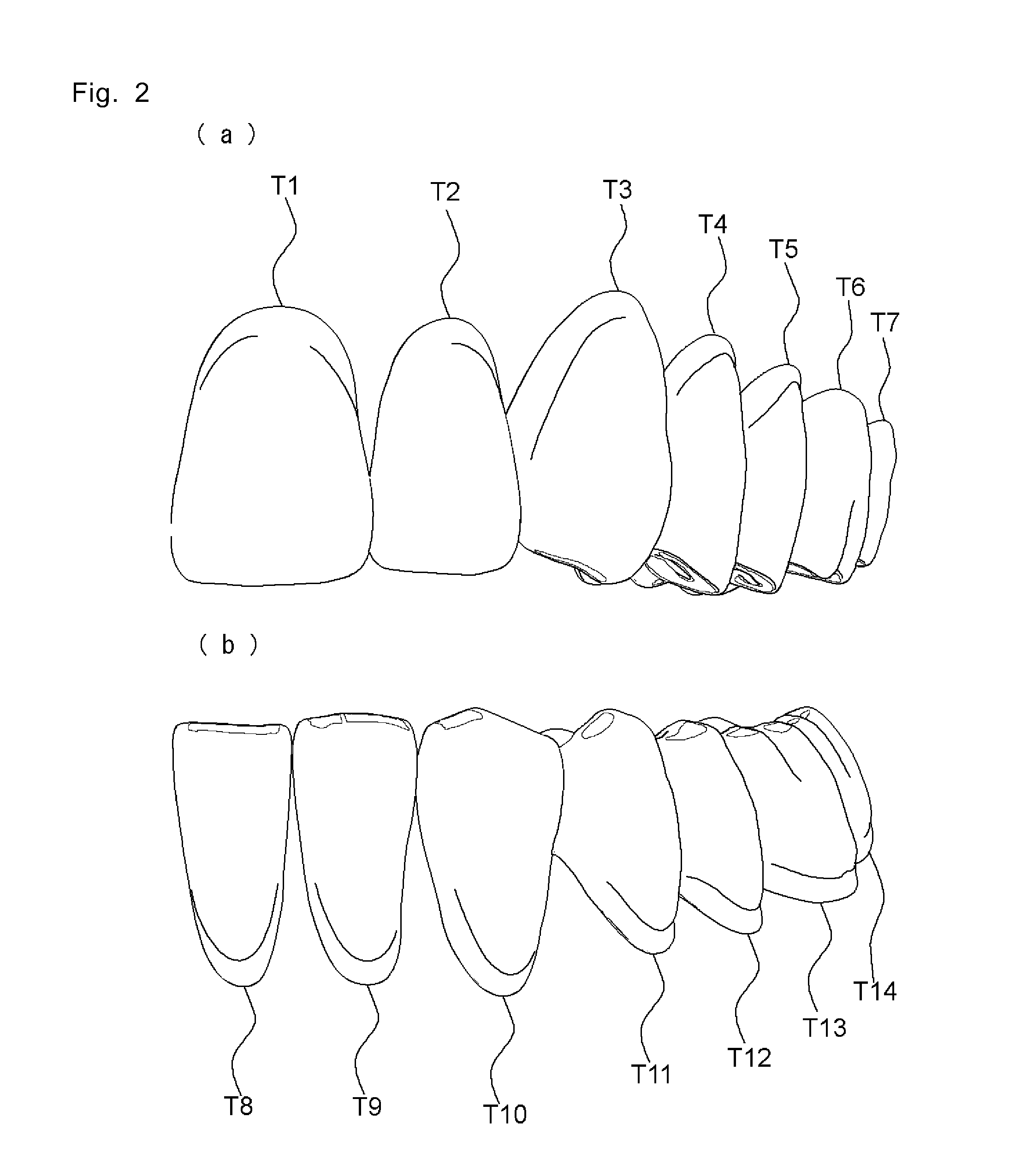 Artificial teeth easily enabling bilateral balanced occlusion