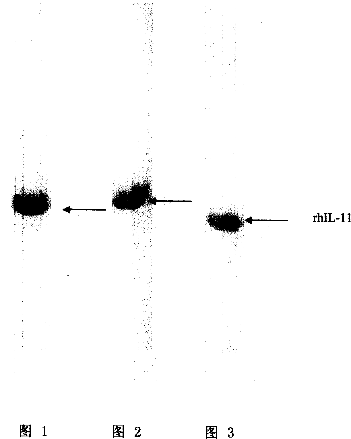 High efficiency finished purification method for colibacillus expression recombinant human interleukin-11