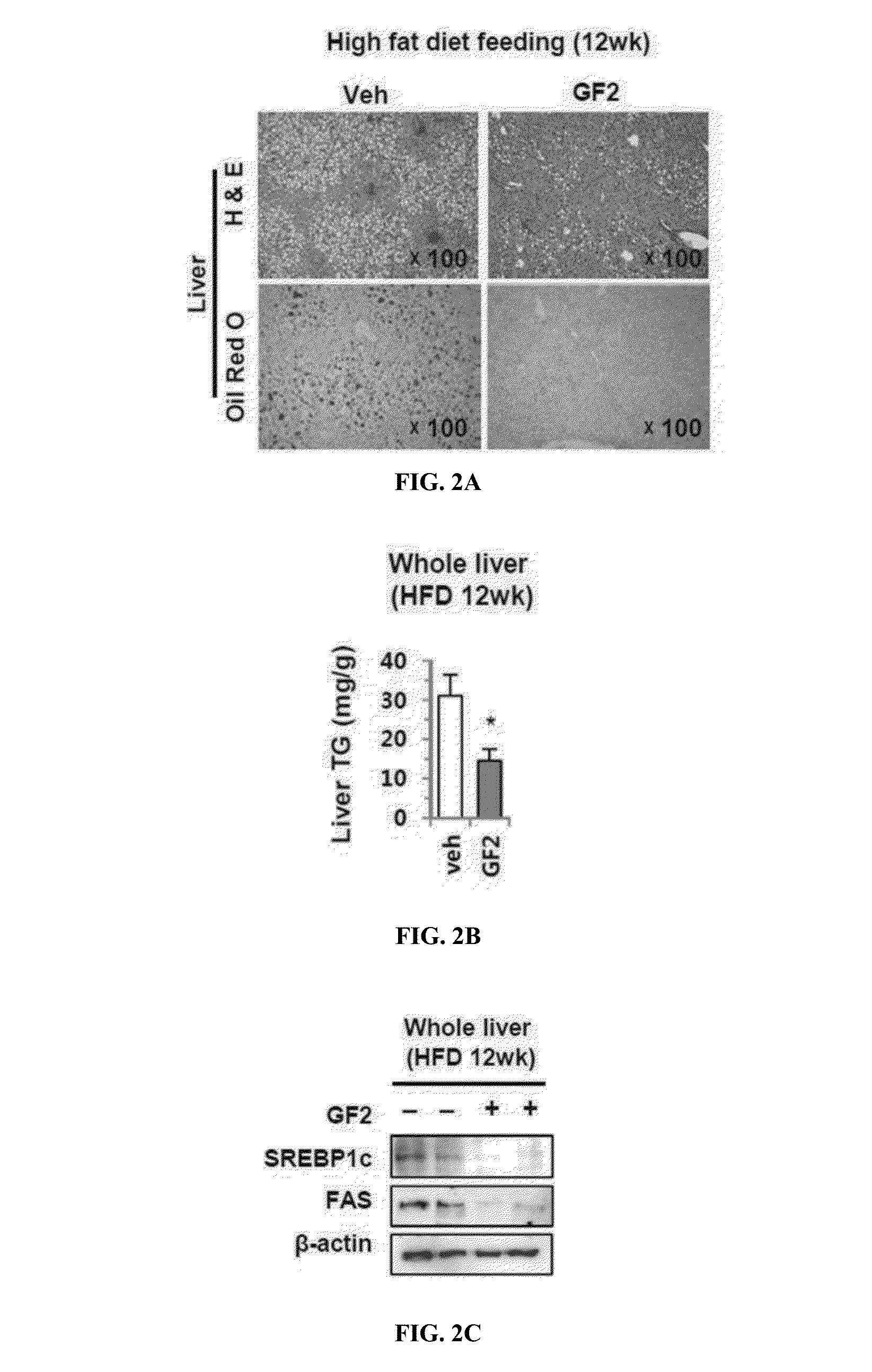 Composition for preventing or treating non-alcoholic liver disease or insulin resistance comprising ginsenoside f2