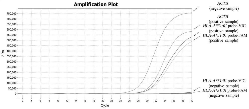 A real-time fluorescent PCR method of mgb probe for detecting hla-a*31:01 allele and its combination of primers and probes