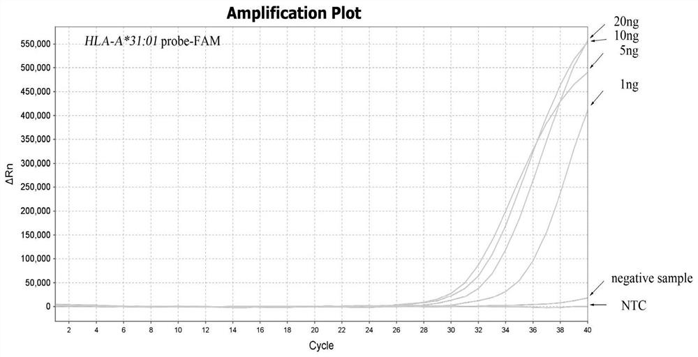 A real-time fluorescent PCR method of mgb probe for detecting hla-a*31:01 allele and its combination of primers and probes