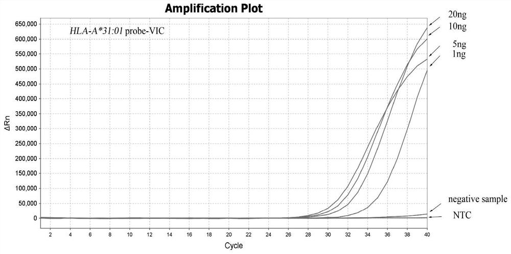 A real-time fluorescent PCR method of mgb probe for detecting hla-a*31:01 allele and its combination of primers and probes