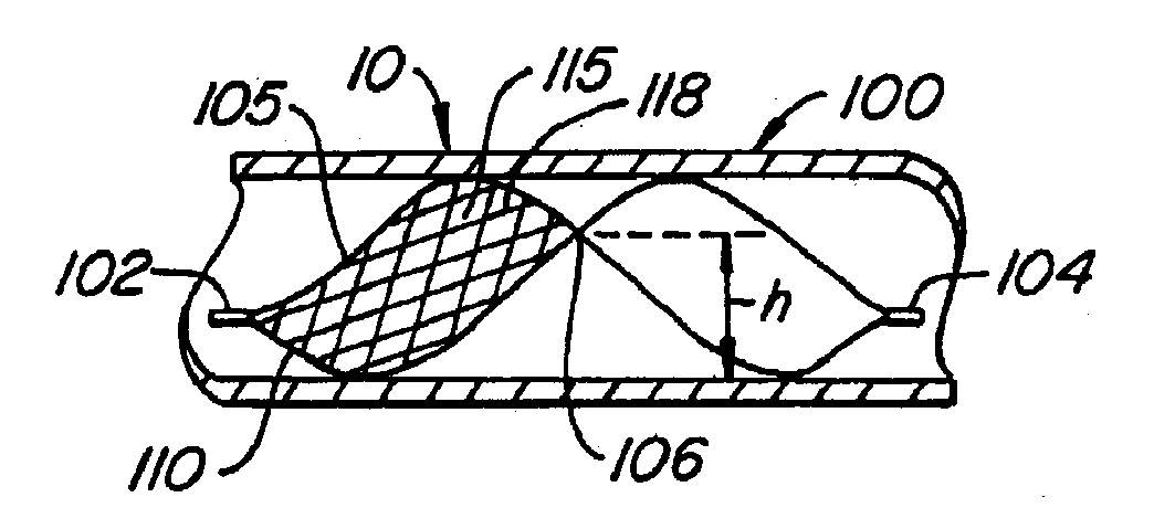 Methods for maintaining a filtering device within a lumen