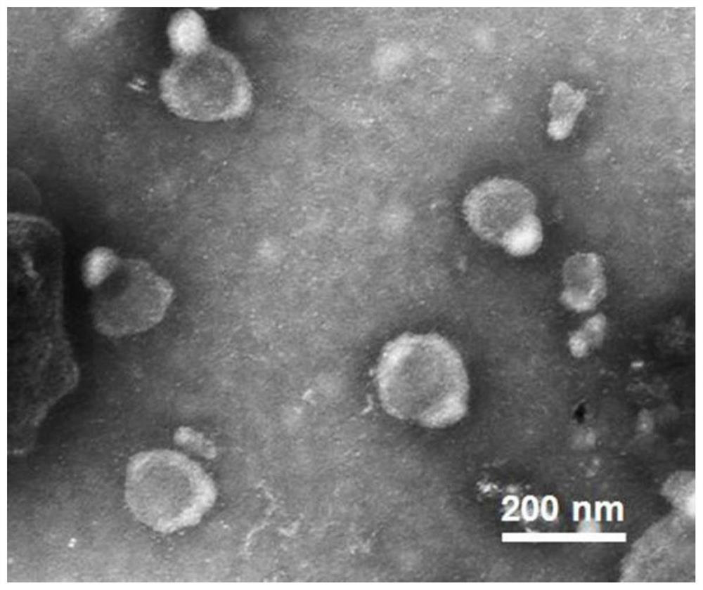 DNA molecular machine for detecting exosomes