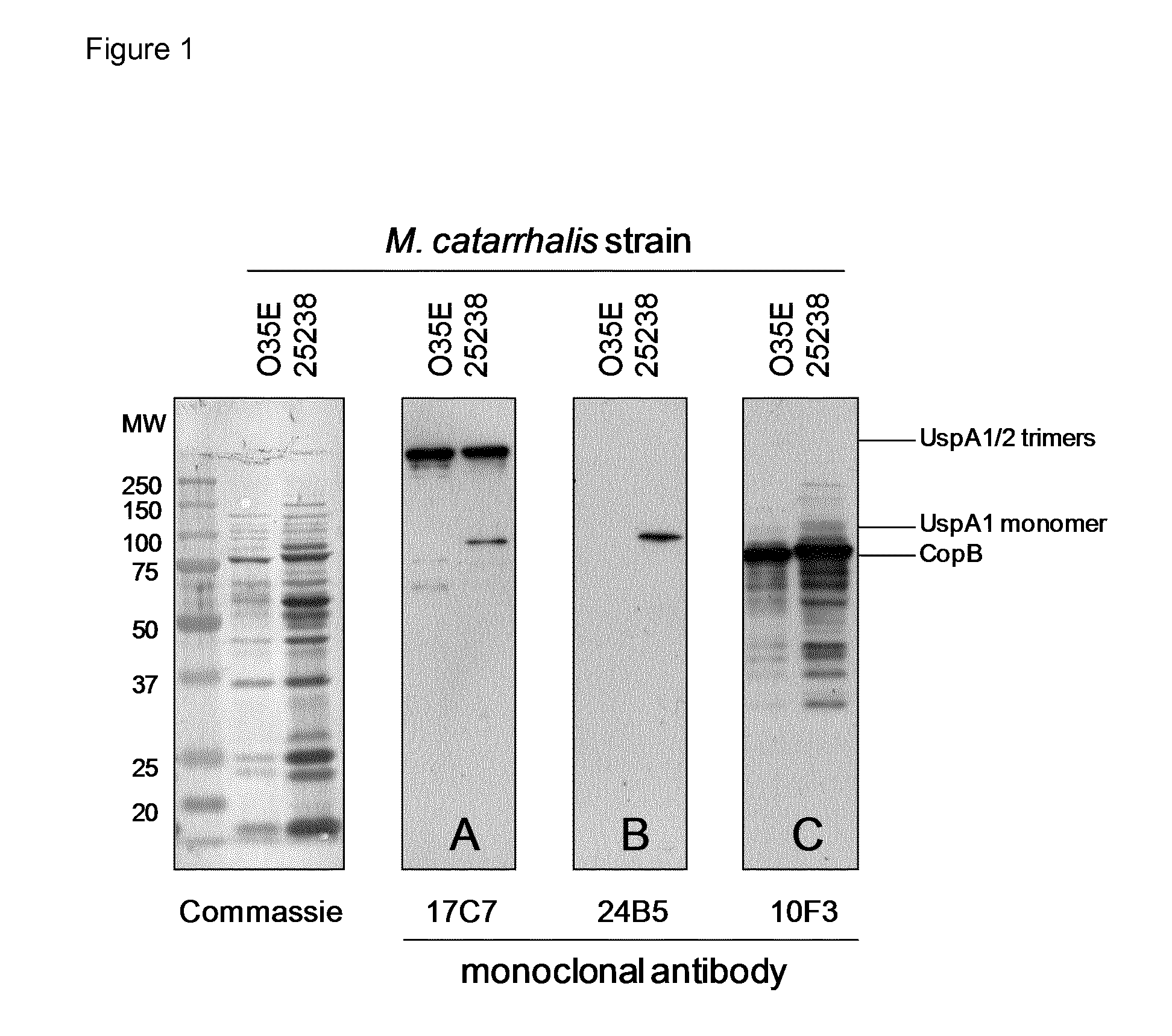 Treatment of mucositis with immunoglobulin