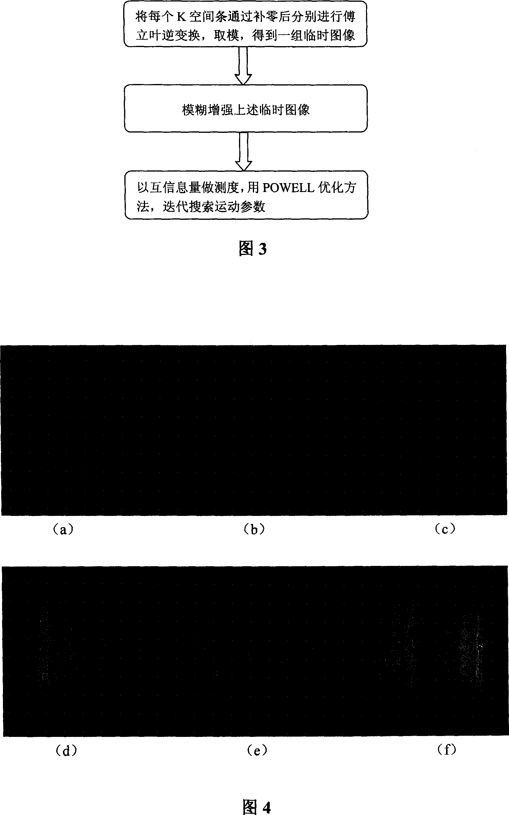 Method of eliminating motion false image using PROPELLER sampling mode in T1 weighted magnetic resaonance imaging