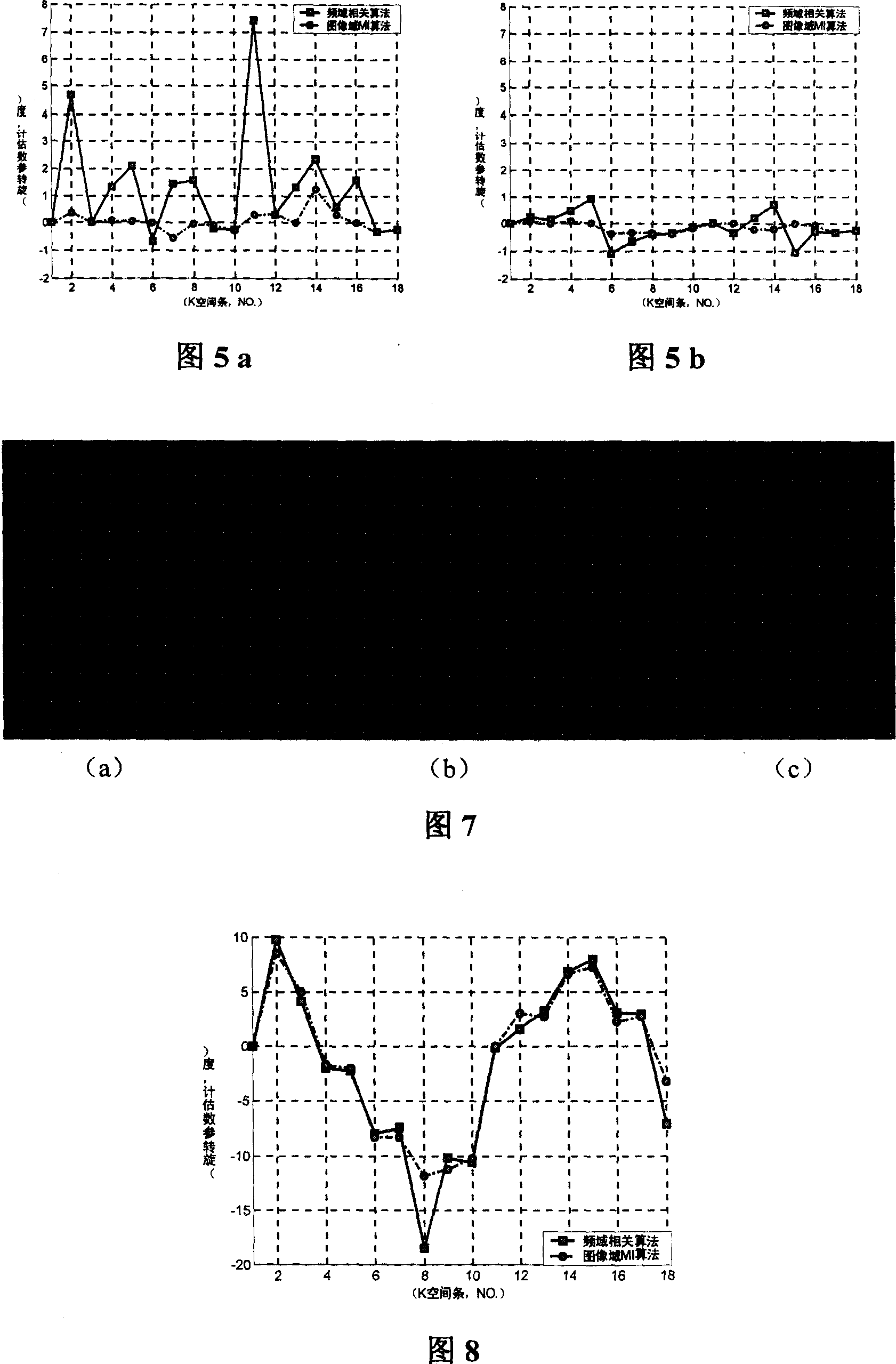 Method of eliminating motion false image using PROPELLER sampling mode in T1 weighted magnetic resaonance imaging