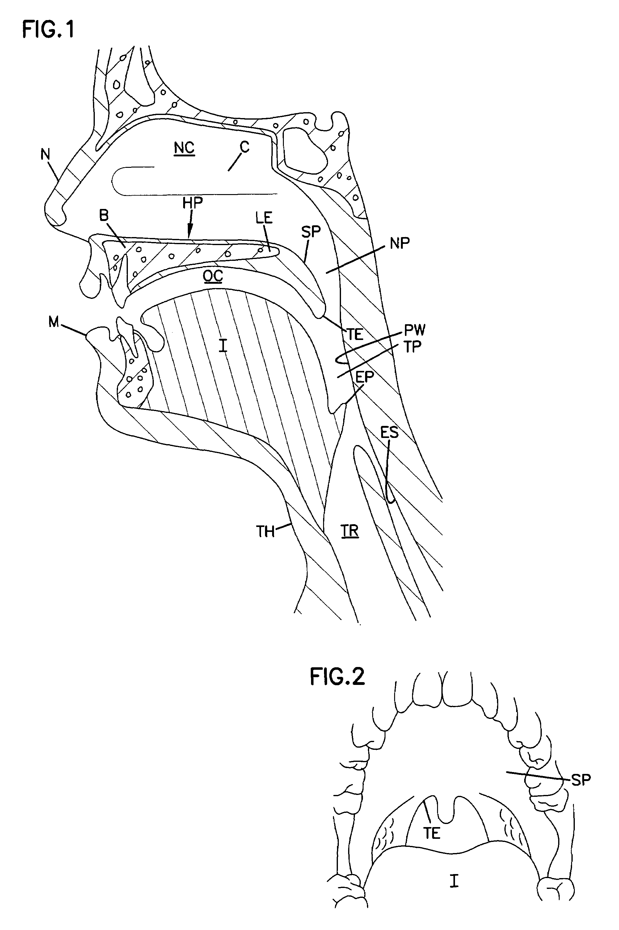 Combination sleep apnea treatment