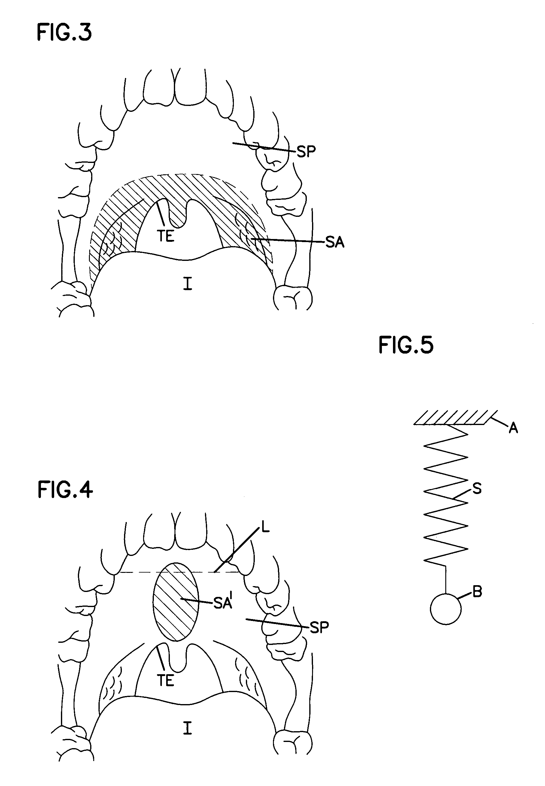 Combination sleep apnea treatment