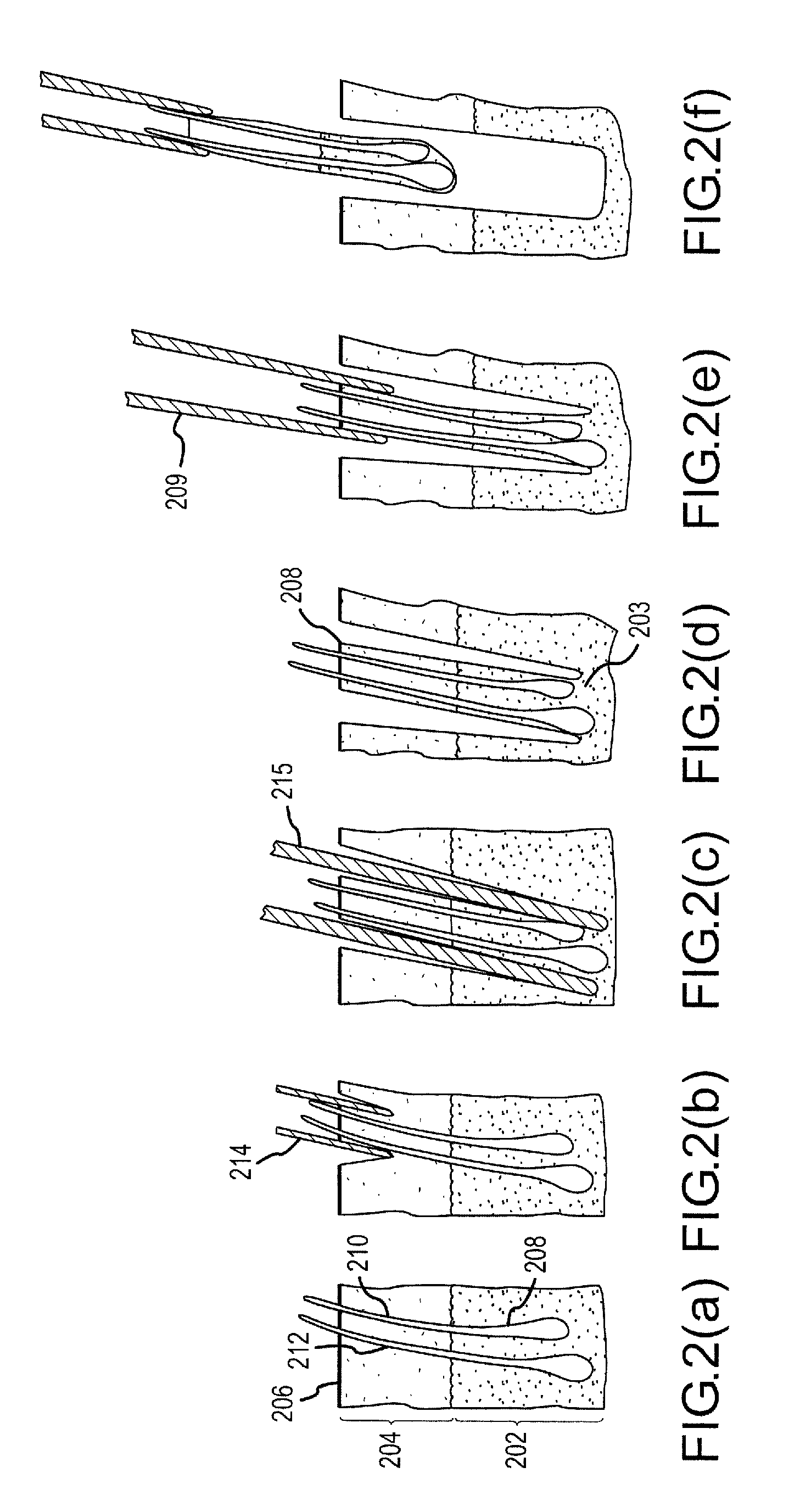 Follicular extraction method and device