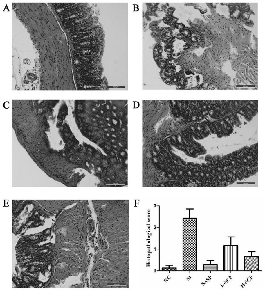 Application of schisandra polysaccharide in preparation of medicine or health product for treating inflammatory bowel disease