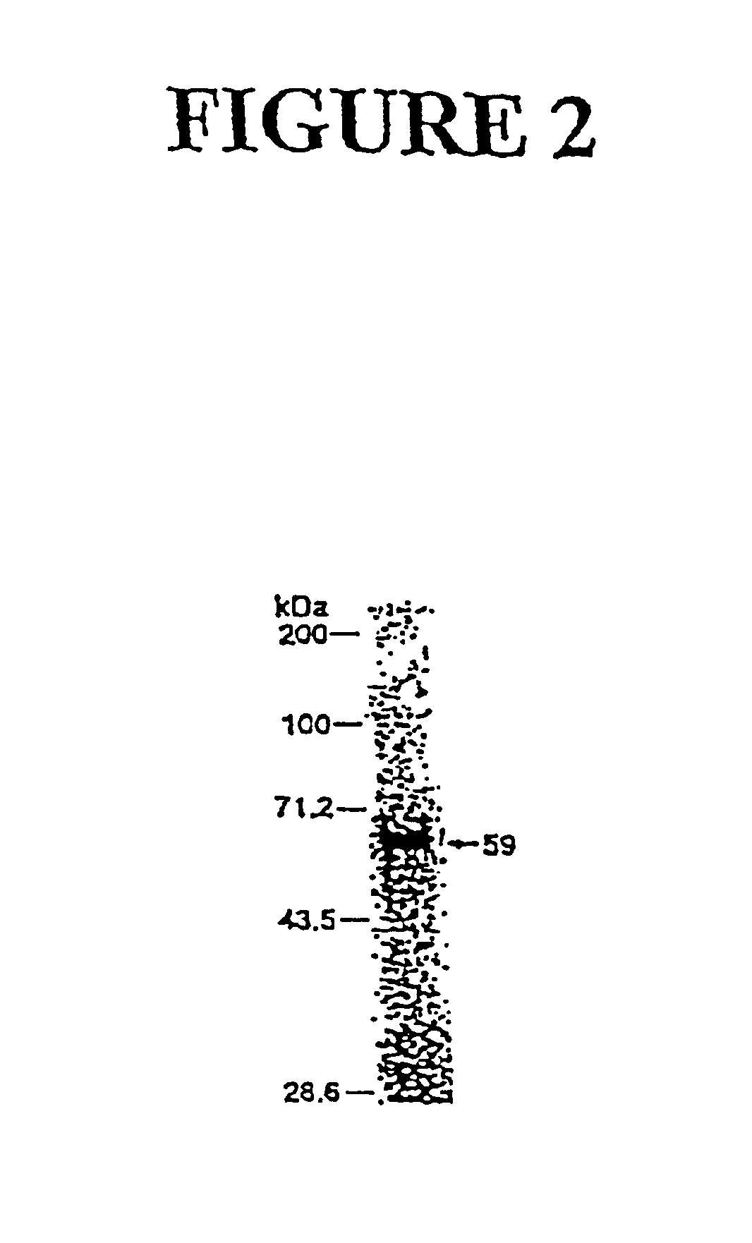 Genes encoding several poly(ADP-ribose) glycohydrolase (PARG) enzymes, the proteins and fragments thereof, and antibodies immunoreactive therewith