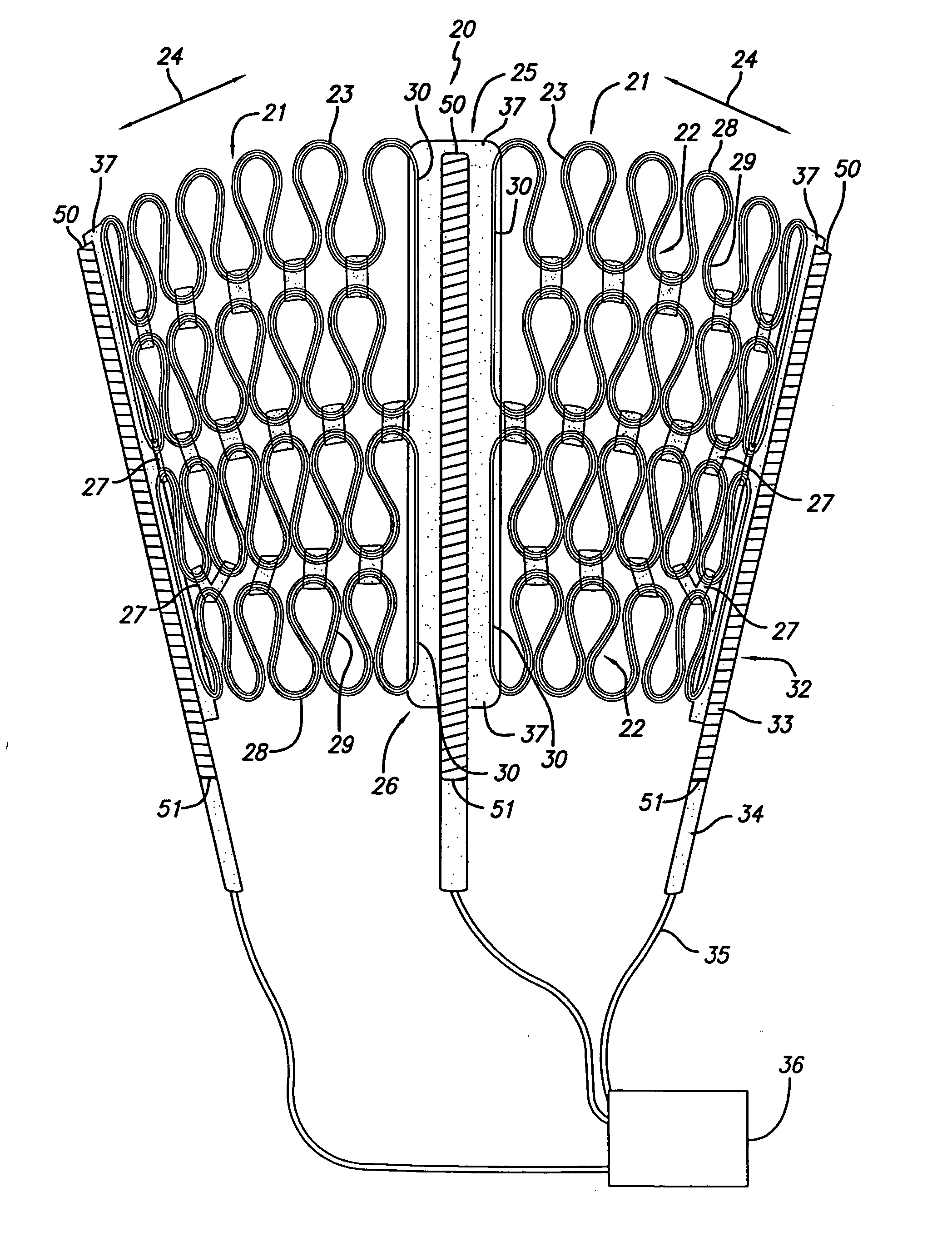 Cardiac harness for treating congestive heart failure and for defibrillating and/or pacing/sensing