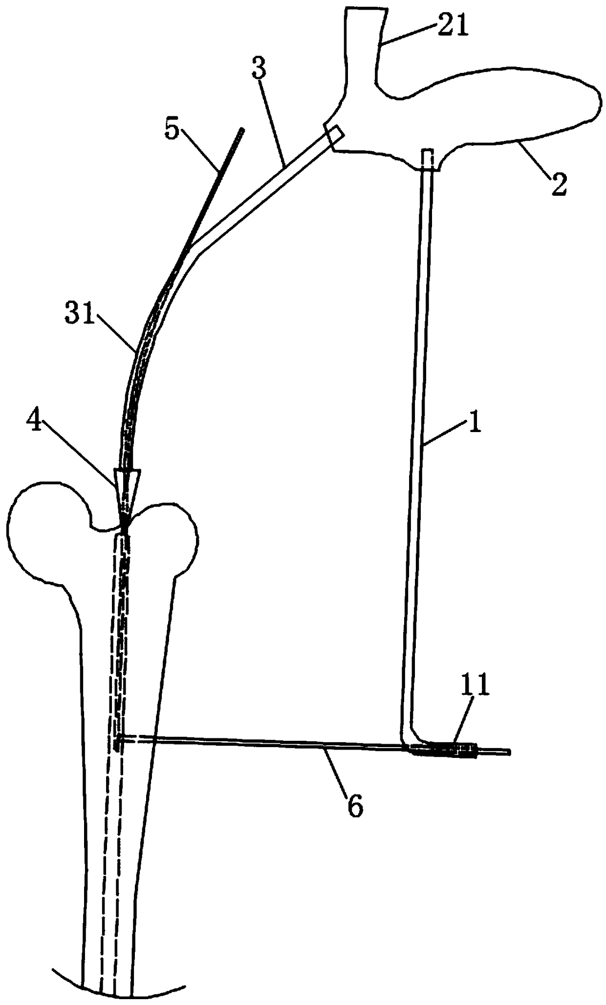 Femoral nail mouth opener with three-dimensional positioning function