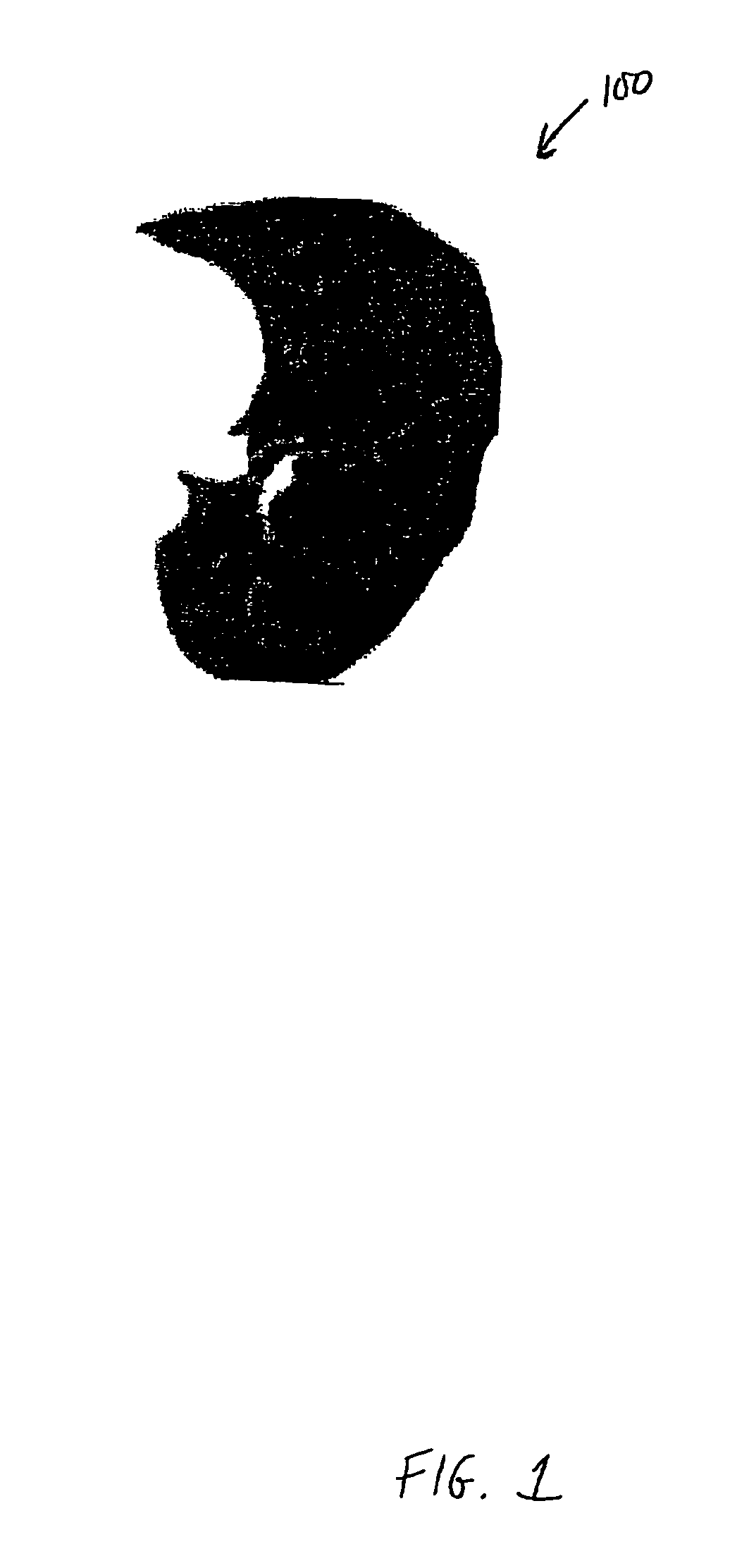 Method and apparatus for airway detection and segmentation