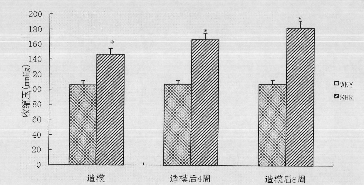 Preparation method of 2-type diabetic nephropathy model