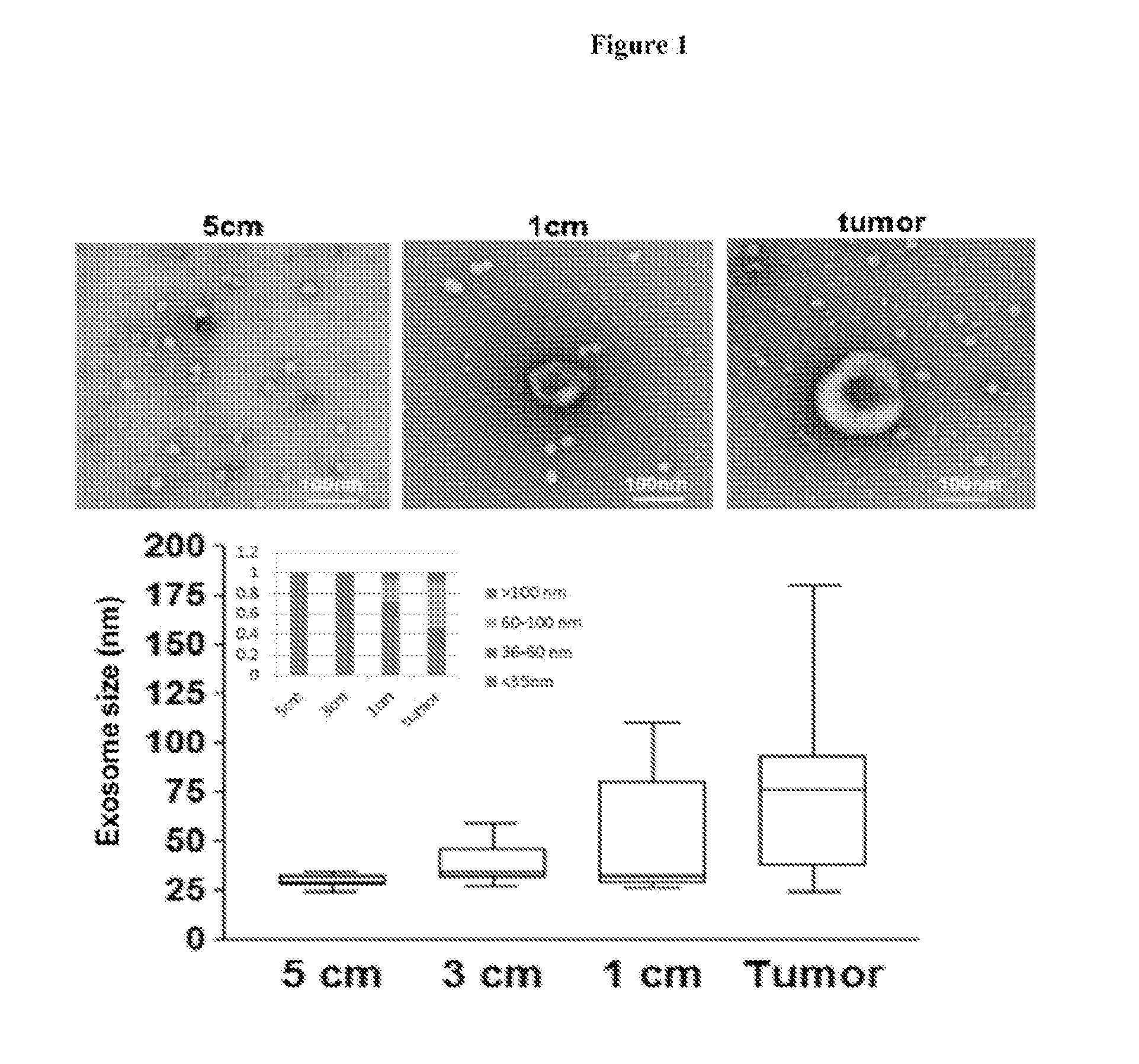 Exosomes as a therapeutic for cancer