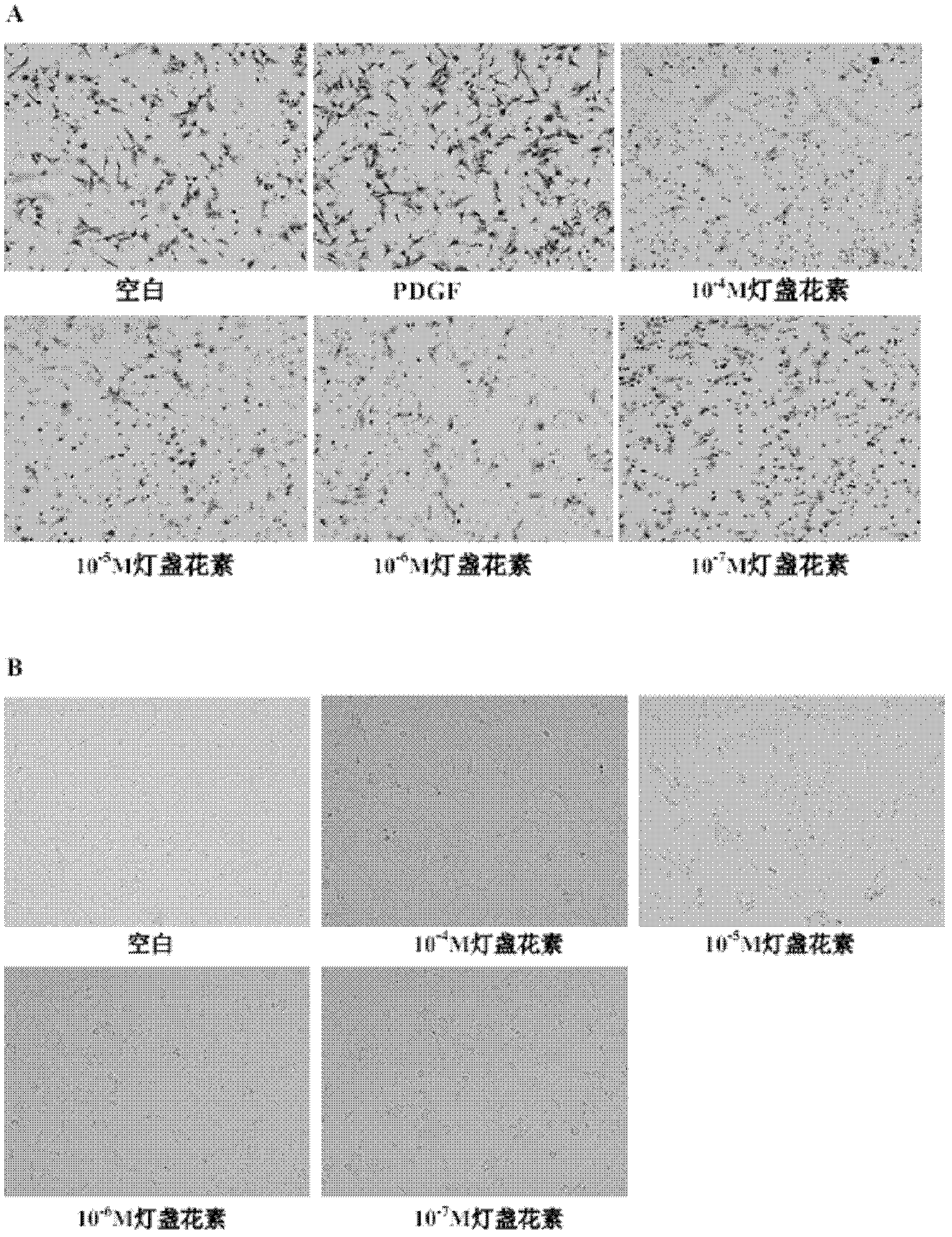 Application of breviscapine in hepatic stellate cell migration inhibition drug preparation