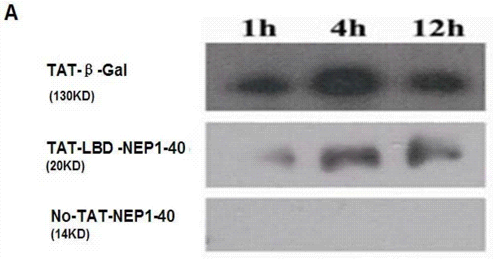 TAT-LBD-NEP1-40 fusion protein, construction method and application thereof