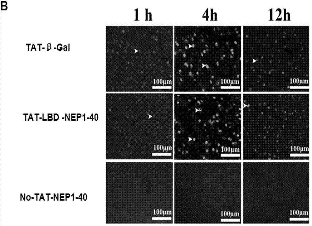 TAT-LBD-NEP1-40 fusion protein, construction method and application thereof