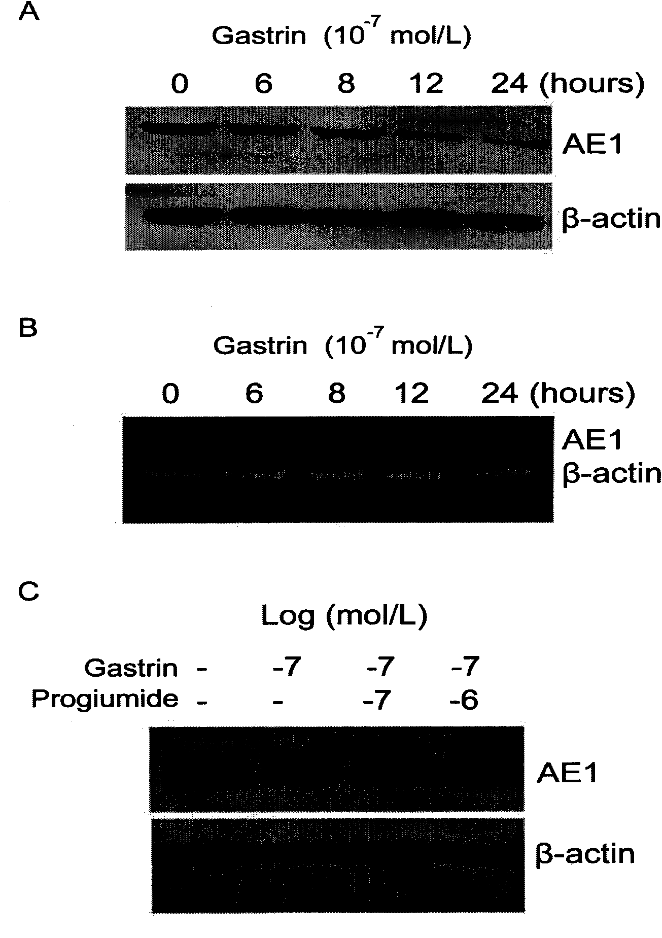 Application of gastrin in inhibiting gastrointestinal tumor tumors