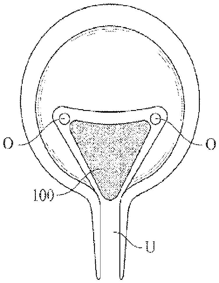 Device and method for modulating pelvic nerve tissue